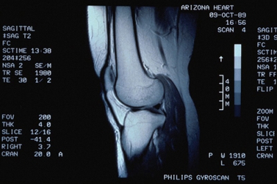 МРТ - диагностика коленного сустава. ultraimaging.am