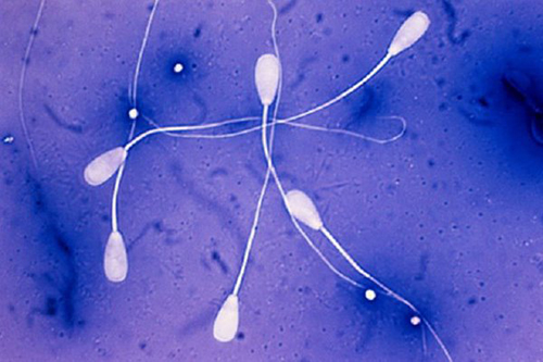 Новый метод предлагает использовать сперматозоиды для борьбы с онкологическими заболеваниями