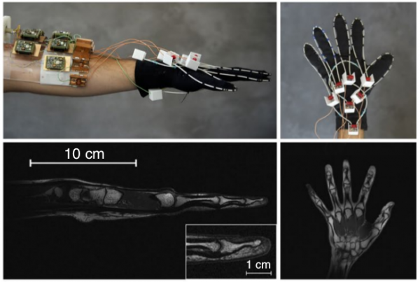 Инженеры создали МРТ-перчатку для исследования руки при ее движении