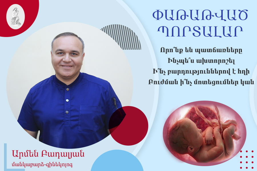 Փաթաթված պորտալար. հարցազրույց Արմեն Բադալյանի հետ. morevmankan.am