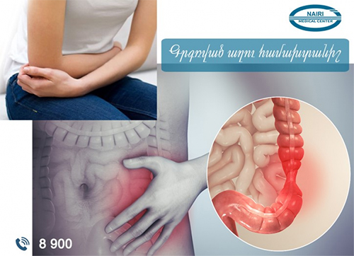 Գրգռված աղու համախտանիշ. nairimed.com