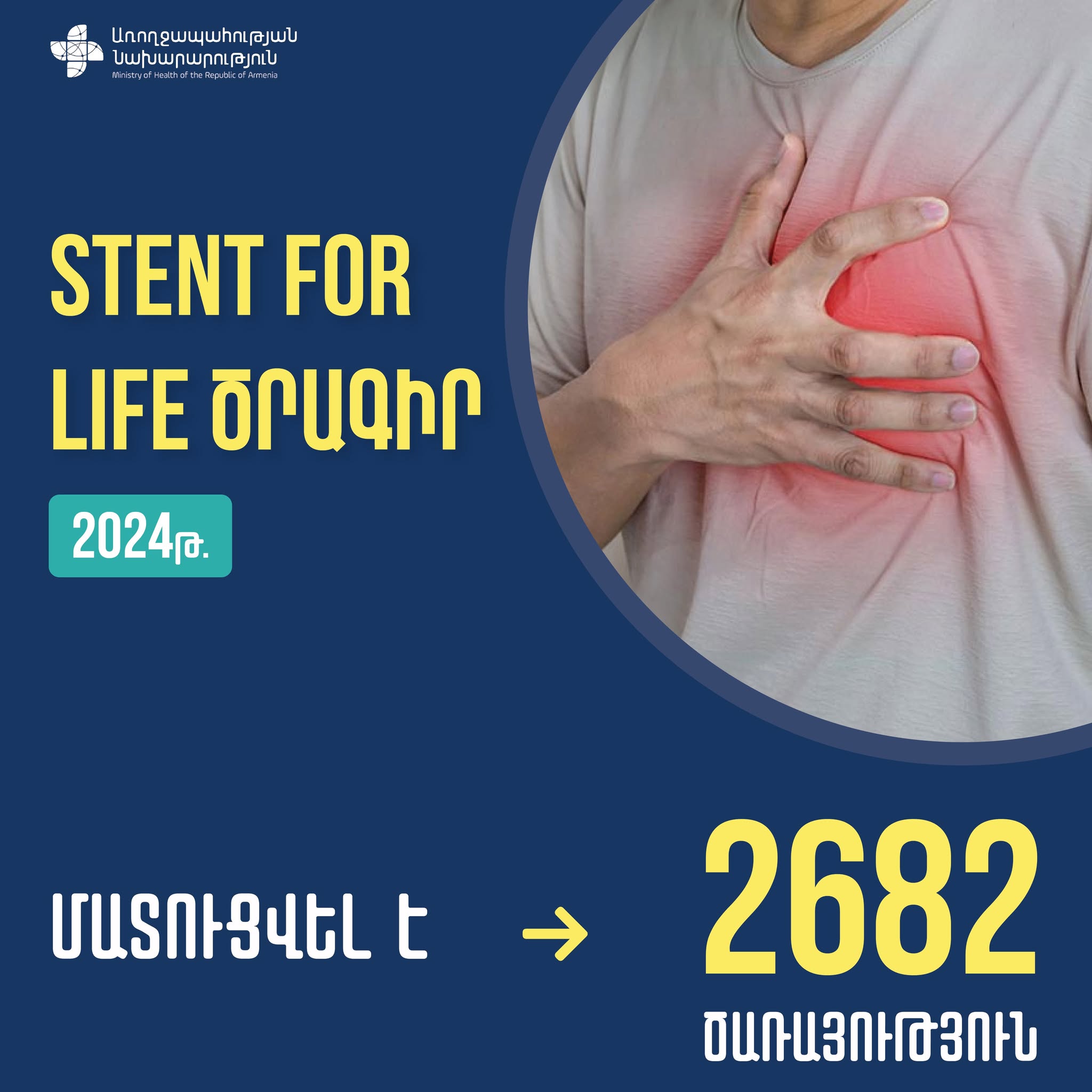 ՀՀ ԱՆ. 2024 թվականին «STENT FOR LIFE» ծրագրով մատուցվել է 2682 ծառայություն