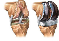 Իտալացի գիտնականները նոր ''ոսկորներ'' են հայտնագործել