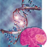 Изменения ДНК на 50% повышают риск опухоли мозга