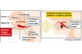 Ճապոնացի գիտնականները մարդու լեզվի պրոթեզ են փորձարկում. 1in.am