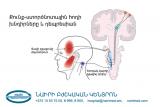 Քունք-ստործնոտային հոդի խնդիրները և դեպրեսիան. nairimed.com