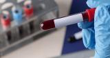 У женщины из Гваделупы ученые обнаружили новую группу крови
