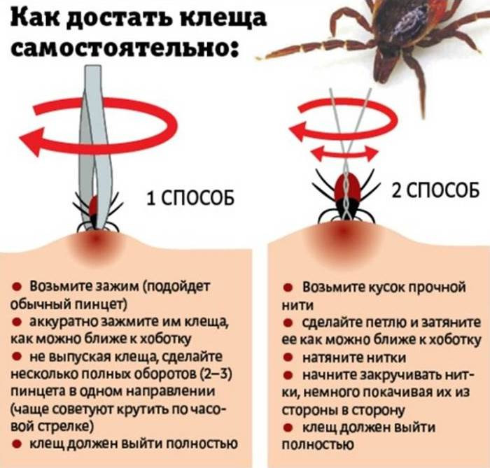 Как вытащить клеща: действенные и безопасные способы