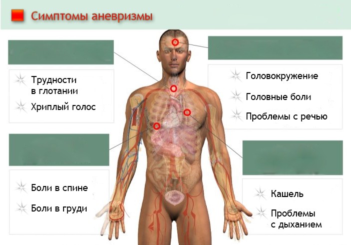 Эксперты рассказали о смерти во время сна