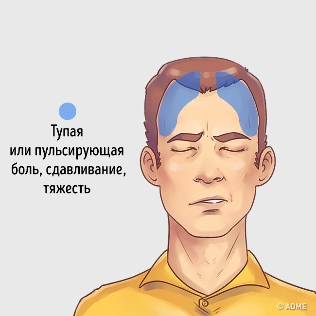 Похмелье