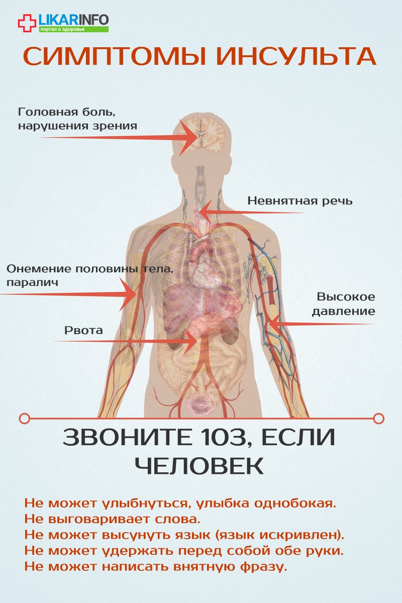 Как распознать первые признаки инсульта и оказать первую помощь