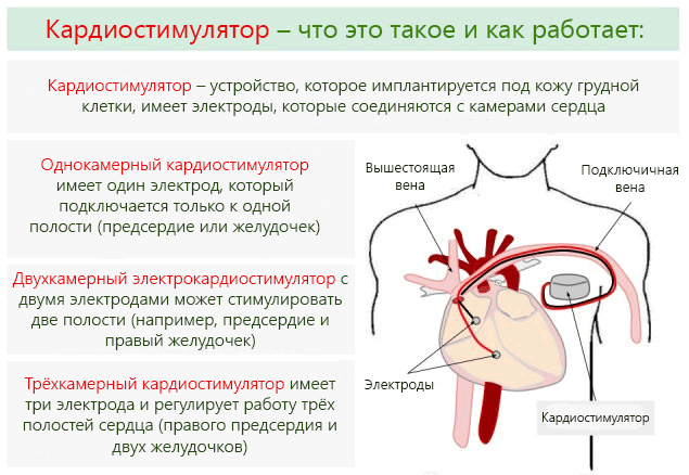 Эксперты рассказали о смерти во время сна