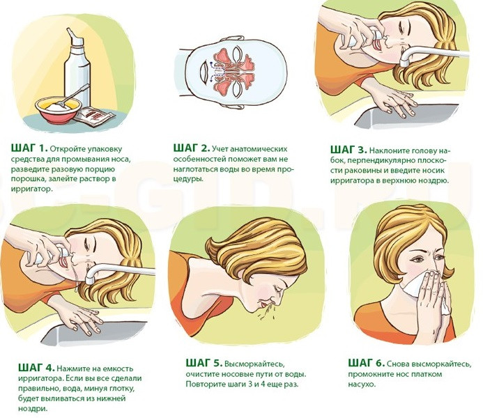  Как правильно промывать нос?