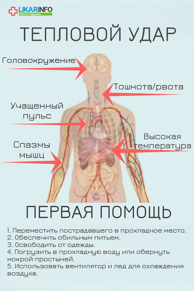 Тепловой удар: первая помощь