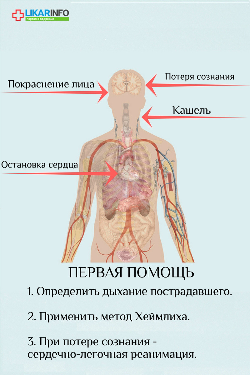 что делать если подавился