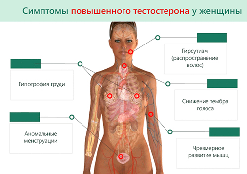 Гиперандрогения у женщин 