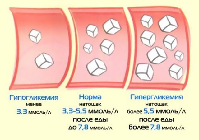 Каротиноиды «выключают» ген диабета 