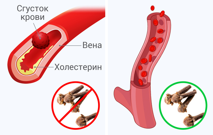 Что произойдет с вашим телом, если вы будете съедать по 2 бутона гвоздики в день